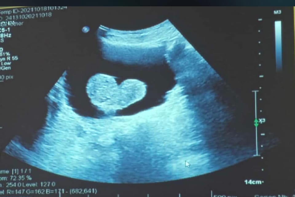 🏞️ #171 Lucas geht, Geburtstagsfeier und Pläne für den Urlaub